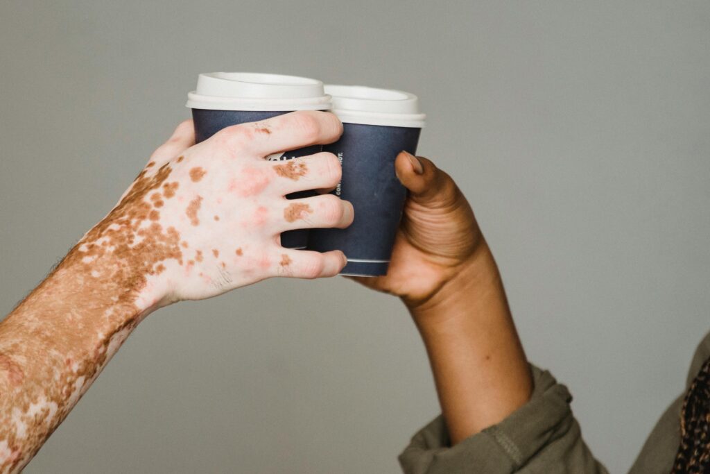pexels-photo-5301732-5301732 coffee for skin benefits Unrecognizable man with vitiligo skin and anonymous African American male clinking with hot drinks on gray background during coffee break